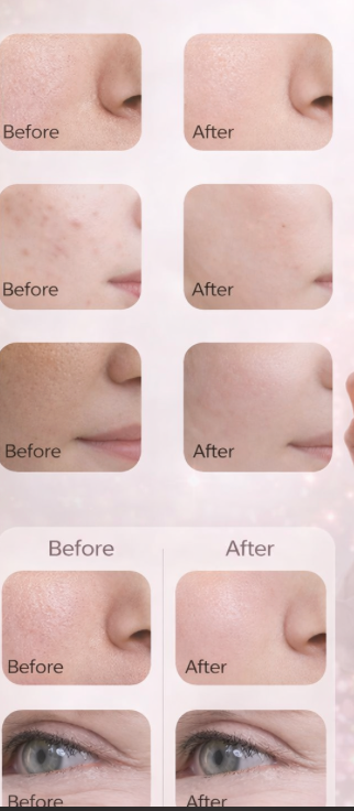 LED маска за лице и шия 7 цвята Photon Skin Beauty